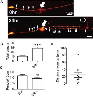 A Select Subset of Electron Transport Chain Genes Associated with Optic Atrophy Link Mitochondria to Axon Regeneration in Caenorhabditis elegans